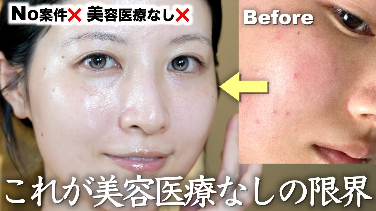 【案件❌ほぼ3000円以下】美容医療なしで圧倒的美肌になった最新スキンケアルーティン全部見せます!
